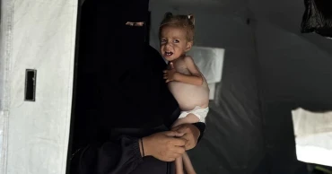 খাবারের অভাবে হাড্ডি-চর্মসার হয়ে গেছে গাজার শিশুরা: চিকিৎসক