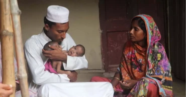 কুষ্টিয়ার জোড়া লাগা সেই জমজ দুই শিশুর ঢামেক হাসপাতালে মৃত্যু