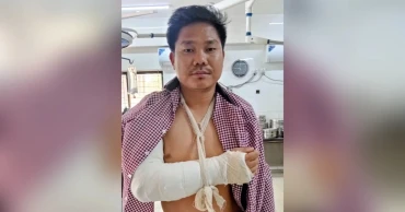 অকটেন না পেয়ে ট্যাগ কর্মকর্তাকে পিটিয়ে হাত ভেঙ্গে দেওয়ার অভিযোগ