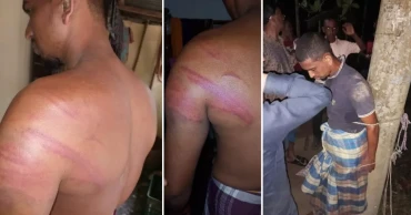 চোর সন্দেহে বুদ্ধিপ্রতিবন্ধী যুবককে খুঁটিতে বেঁধে মারধর