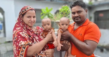 ঢামেকে চার ঘণ্টার সফল অস্ত্রোপচারে আলাদা হলো জমজ জুহি ও রুহি, আজ ফিরছে বাড়িতে