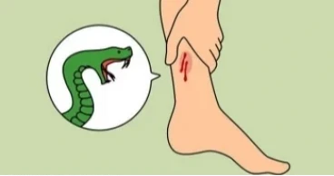 মাগুরায় সাপের কামড়ে এইচএসসি পরীক্ষার্থীর মৃত্যু