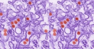 চট্টগ্রামে প্রথমবারের মতো দুইজনের শরীরে জিকা ভাইরাস শনাক্ত