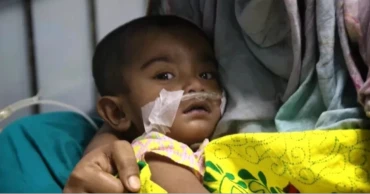 3 more die from measles-like symptoms in Sylhet