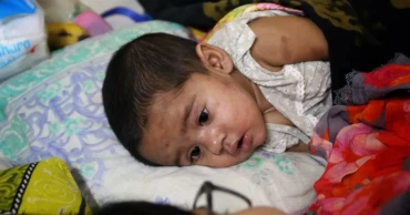 4 suspected measles patients die in 24 hours: DGHS