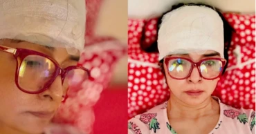 Actress Elina Shammi injured in electronic rickshaw accident