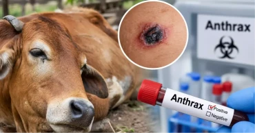 Anthrax detected in 3 of 11 people tested in Rangpur