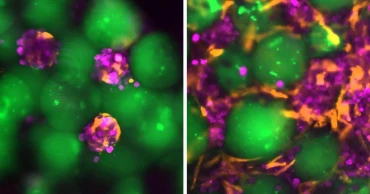 MIT researchers develop injectable ‘mini livers’ to support damaged organs