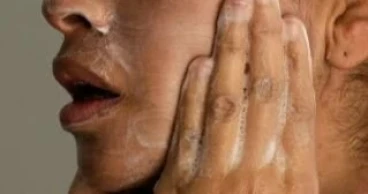 Adult acne is common, but effective treatments are available