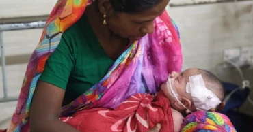 Two more children die with measles symptoms in Sylhet
