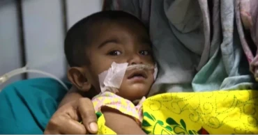Another child dies with measles-like symptoms in Sylhet