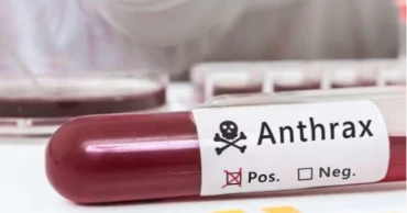 9 more detected with anthrax in Rangpur