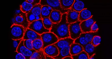 New drug offers hope for advanced pancreatic cancer treatment