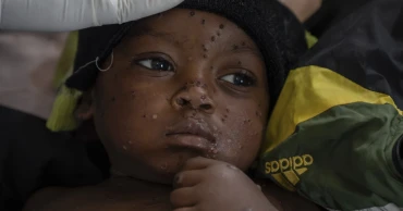 A gold mining town in Congo has become an mpox hot spot as a new strain spreads