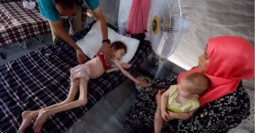 Malnutrition worsens in Gaza, women and children severely affected