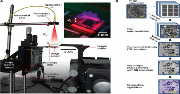 Chinese university students develop advanced lens-free microscope