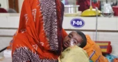 হামের উপসর্গ নিয়ে আরও ৩ প্রাণহানি, আক্রান্ত ৮৭২