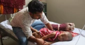 হামের উপসর্গ নিয়ে আরও ৬ প্রাণহানি, আক্রান্ত ১,২৫৬