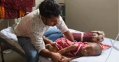 হামের উপসর্গ নিয়ে আরও ৫ প্রাণহানি, আক্রান্ত ১১৭০