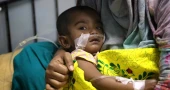 হামের উপসর্গ নিয়ে আরও ১১ শিশুর মৃত্যু, আক্রান্ত ১২৮৭