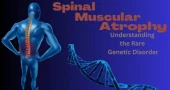 বাংলাদেশে বিরল রোগ এসএমএ চিকিৎসায় আশার আলো