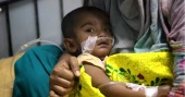 হাম ও হামের উপসর্গ নিয়ে আরও ১২ শিশুর মৃত্যু, আক্রান্ত ১৩০৩