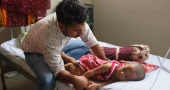 হামের উপসর্গ নিয়ে আরও ৩ প্রাণহানি, আক্রান্ত ১০৭২