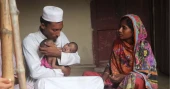 Conjoined twins from Kushtia die at DMCH