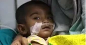 Five more children die from measles-like symptoms, toll rises to 648