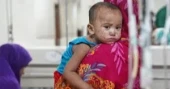 One more suspected measles death recorded in Bangladesh