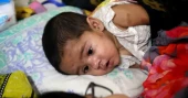 Measles: Death toll climbs to 555 with 10 more deaths in 24 Hrs