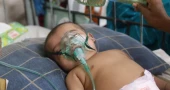 Bangladesh reports 2 more suspected measles deaths, toll reaches 731