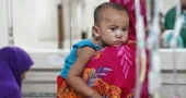 Measles: Daily cases stay above 1000 even during holidays, 8 more die