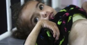 Gaza's main hospital overwhelmed with children in pain from malnutrition