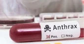 9 more detected with anthrax in Rangpur