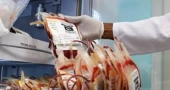 West African scientists urge stronger disease outbreak detection