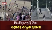 অস্ট্রেলিয়ার ইতিহাসে ভয়াবহতম বন্দুক হামলা: সিডনিতে ইহুদি উৎসবে গুলিতে নিহত ১৬ | Bondi Shooting | UNB