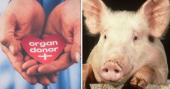 Successful transplant of pig's heart into a human body for the first time