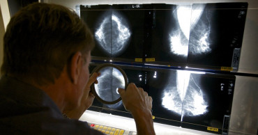 Breast cancer risk from menopause hormones may last decades