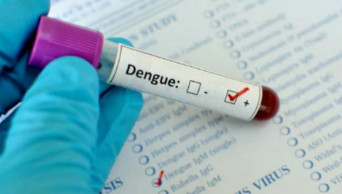 HC wants steps against charging of excessive fees for Dengue tests
