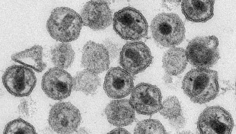 A gene-editing first: scientists tried CRISPR to fight HIV