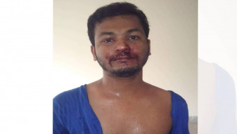 Chhatra League activists assault Dhaka University student