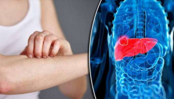 High iron linked to diabetes, liver disease: study