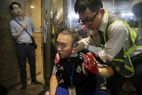 Hong Kong police say knife-wielding attacker detained