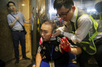 Attacker bites politician's ear, others slashed in Hong Kong