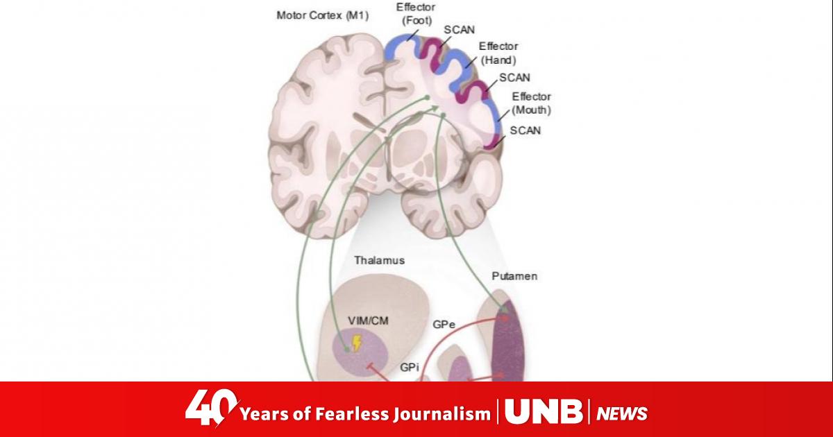 Chinese scientists identify key brain network in Parkinson’s disease
